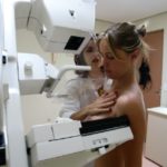 Una mamografía permite al médico tener una mirada más atenta a los cambios en el tejido mamario